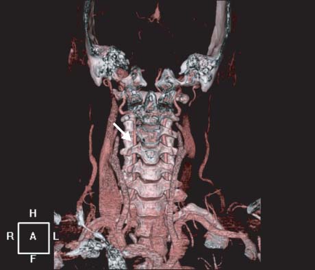emj-37-41-g006.jpg