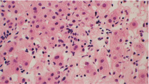 emj-39-81-g003.jpg